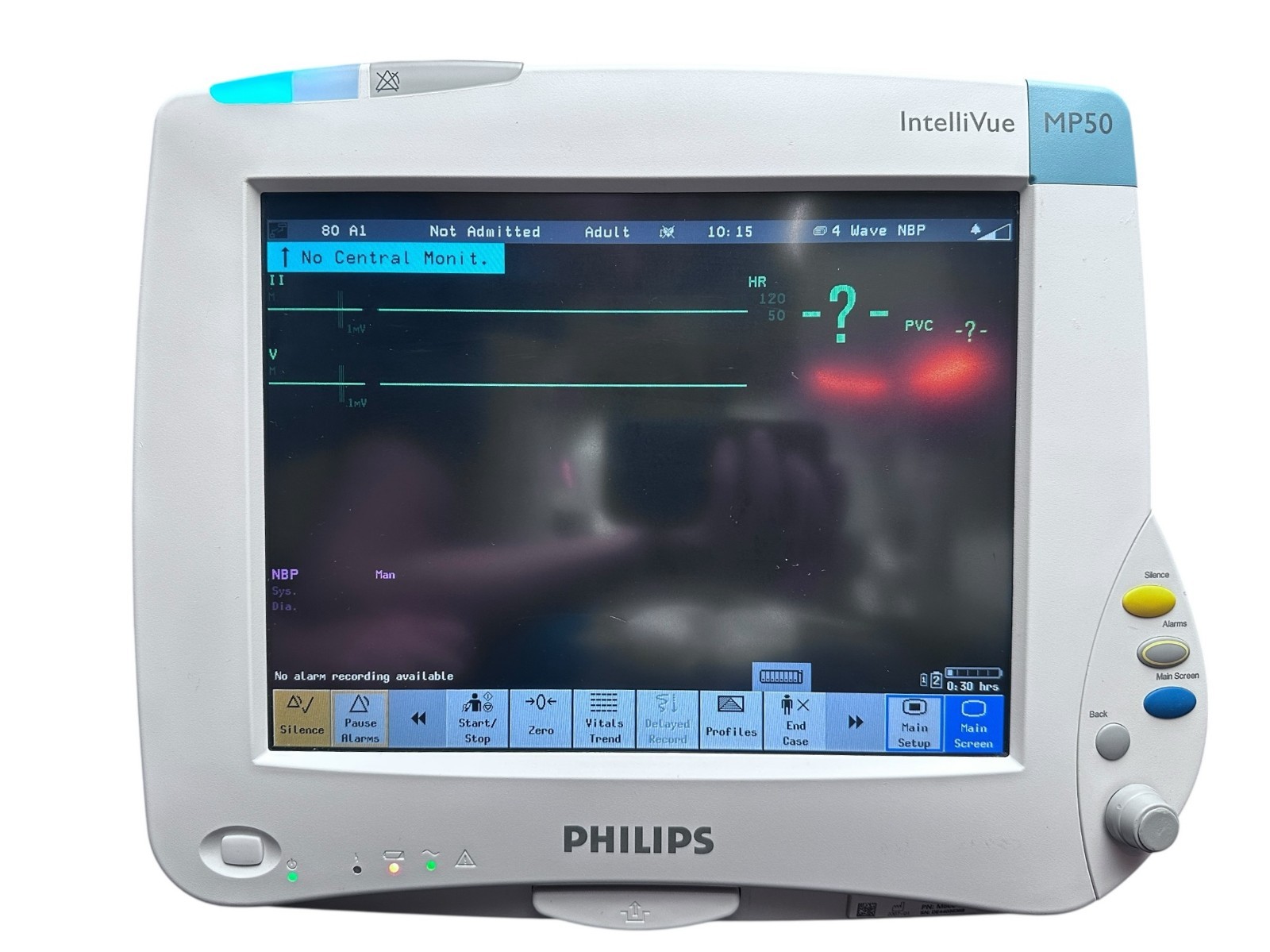 Philips IntelliVue MP50 Patient Monitor – w/ M1116B, M3001A, M1032A, and Battery available from Noble Lab Trade